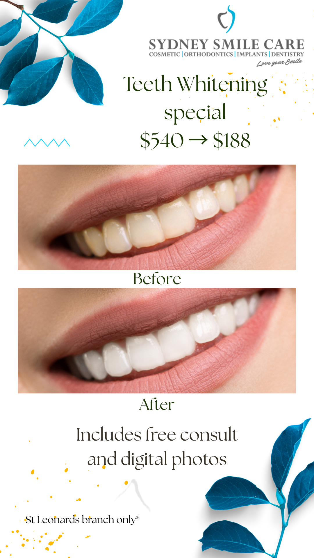 Beige Before and After Cleaning Teeth Instagram Story (1)